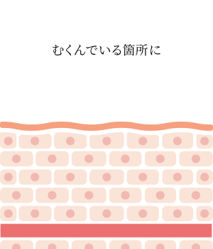 ラジオ波