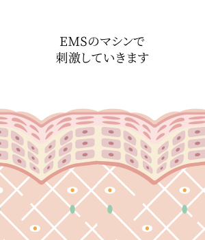 EMS